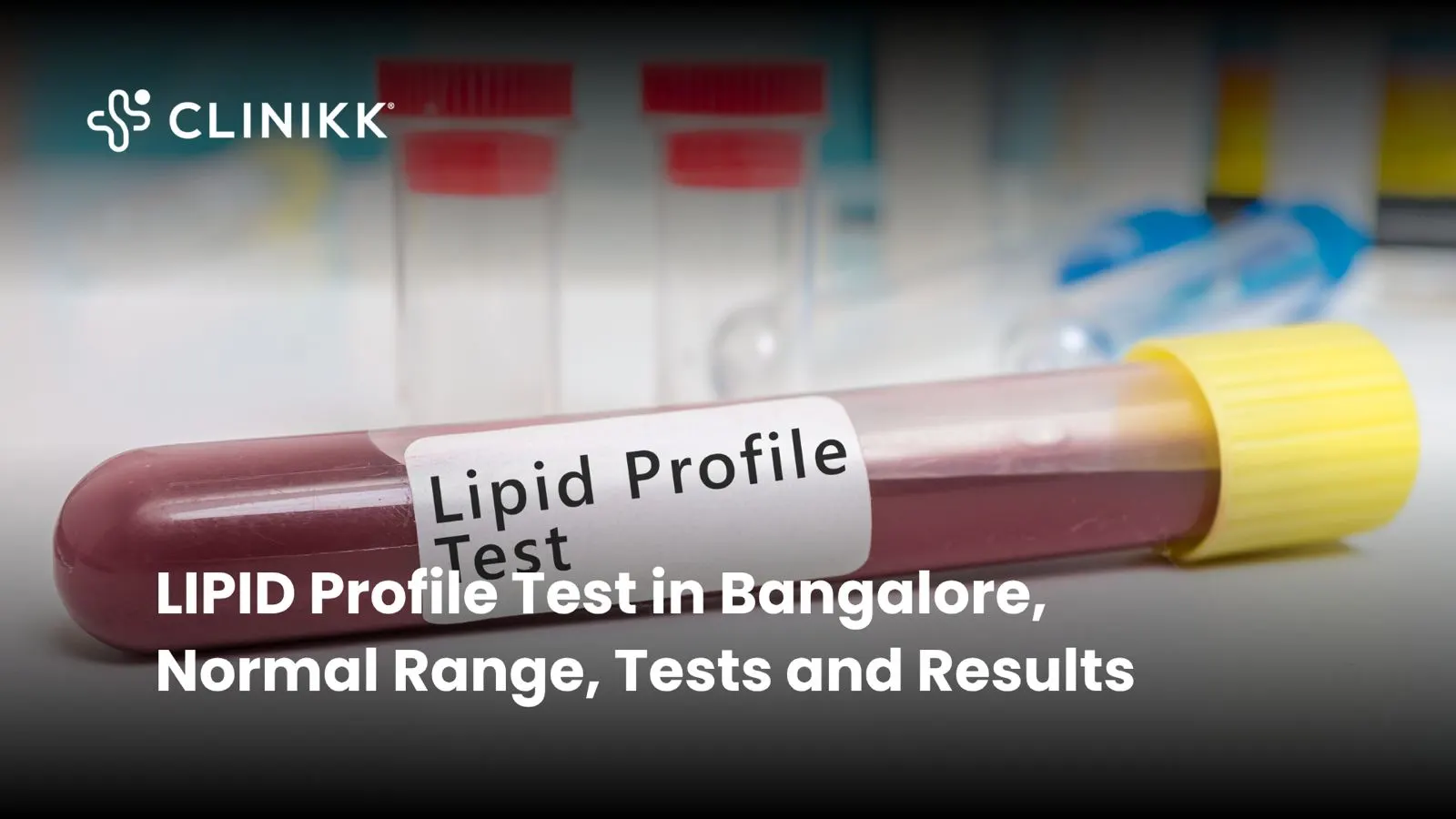 LIPID Profile Test in Bangalore, Normal Range, Tests and Results