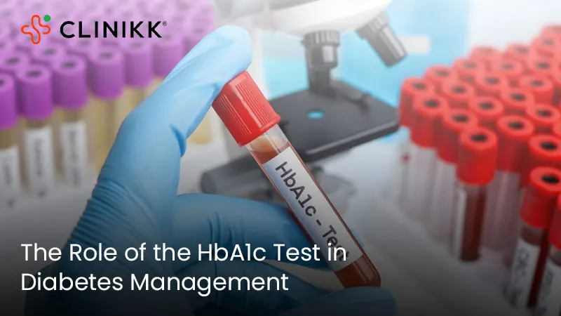 The Role of the HbA1c Test in Diabetes Management