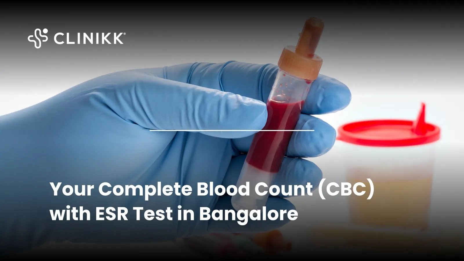 Your Complete Blood Count (CBC) with ESR Test in Bangalore