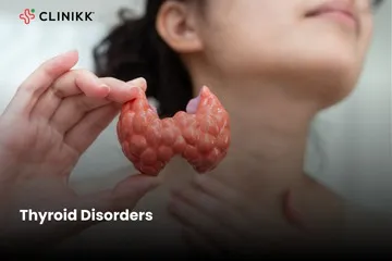 Thyroid Treatment in Bangalore